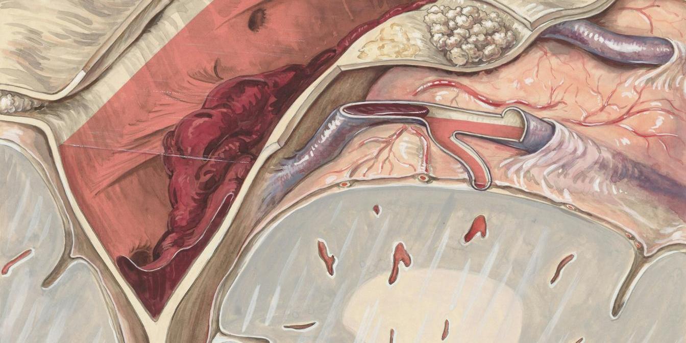 Illustration showing the balance between bone formation and bone resorption